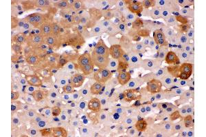 Immunohistochemistry (Paraffin-embedded Sections) (IHC (p)) image for anti-Transferrin (TF) (AA 20-49), (N-Term) antibody (ABIN3043419) (Transferrin Antikörper  (N-Term))