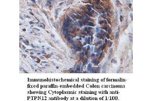 Image no. 1 for anti-Protein Tyrosine Phosphatase G1 (PTPN12) antibody (ABIN791170) (PTPN12 Antikörper)
