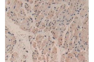 Immunohistochemistry (IHC) image for anti-Caspase 3 (CASP3) (AA 29-175) antibody (ABIN7442660)