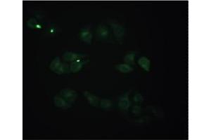 Staining of methanol-fixed Hela cells by Immunocytochemistry using Mouse anti-Human beta 2 Microglobulin monoclonal antibody (D2E9) at 1/50 (20 µg/ml). (beta-2 Microglobulin Antikörper)