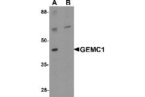 Western blot analysis of GEMC1 in mouse heart tissue lysate with GEMC1 antibody at 1 µg/mL in (A) the absence and (B) the presence of blocking peptide (GEMC1 Antikörper  (Middle Region))