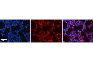 Immunohistochemistry (IHC) image for anti-Activating Transcription Factor 4 (Tax-Responsive Enhancer Element B67) (ATF4) (N-Term) antibody (ABIN2779918)