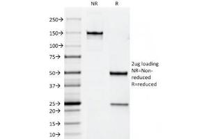 SDS-PAGE Analysis of Purified, BSA-Free ErbB2 Antibody (clone HRB2/258).