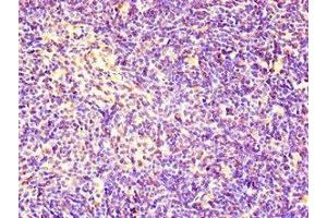 Immunohistochemistry of paraffin-embedded human thymus tissue using ABIN7167020 at dilution of 1:100 (RACGAP1 Antikörper  (AA 86-331))