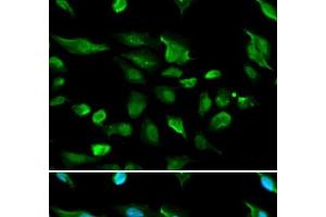 Immunofluorescence analysis of A549 cells using AIRE Polyclonal Antibody (AIRE Antikörper)