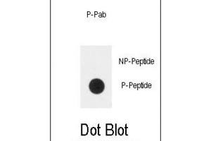 Dot Blot (DB) image for anti-Plexin D1 (PLXND1) (pTyr1642) antibody (ABIN3001877) (PLXND1 Antikörper  (pTyr1642))
