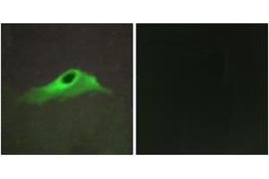 Immunofluorescence (IF) image for anti-Collagen, Type IV, alpha 5 (COL4A5) (AA 21-70) antibody (ABIN2889914) (COL4a5 Antikörper  (AA 21-70))