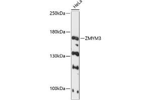 Western blot analysis of extracts of HeLa cells, using ZMYM3 antibody (ABIN6128940, ABIN6150453, ABIN6150454 and ABIN6216809) at 1:3000 dilution. (ZMYM3 Antikörper  (AA 140-300))
