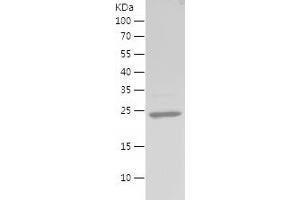 Western Blotting (WB) image for Vimentin (VIM) (AA 2-201) protein (His tag) (ABIN7125715) (Vimentin Protein (VIM) (AA 2-201) (His tag))