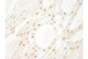 Immunohistochemistry (IHC) image for anti-V-Myb Myeloblastosis Viral Oncogene Homolog (Avian)-Like 2 (MYBL2) (AA 450-500) antibody (ABIN7454417)