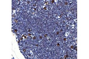 IHC analysis of Il2ra using anti-Il2ra antibody (ABIN7600684). (CD25 Antikörper  (AA 22-268))