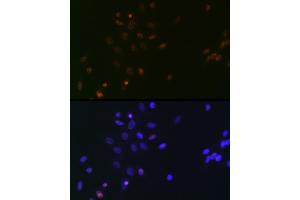 Immunofluorescence analysis of NIH/3T3 cells using SUPT5H/SPT5 Rabbit mAb (ABIN7270878) at dilution of 1:100 (40x lens). (SUPT5H Antikörper)