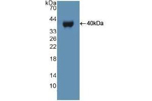 Western blot analysis of recombinant Human UBE3A. (ube3a Antikörper  (AA 158-407))
