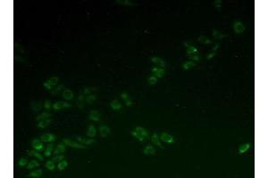 Figure. (HCCS Antikörper  (AA 1-268))