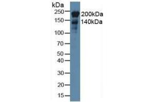 Detection of NES in Rat Heart Tissue using Monoclonal Antibody to Nestin (NES) (Nestin Antikörper  (AA 178-399))