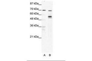 Image no. 1 for anti-DEAD (Asp-Glu-Ala-Asp) Box Polypeptide 55 (DDX55) (AA 92-141) antibody (ABIN6736047) (DDX55 Antikörper  (AA 92-141))