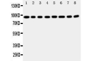 Western Blotting (WB) image for anti-Coagulation Factor VIII (F8) (AA 1264-1278), (Middle Region) antibody (ABIN3042924) (Factor VIII Antikörper  (Middle Region))