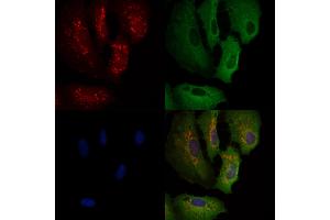 ABIN6260988 and ABIN6266937 staining  cells by IF/ICC.