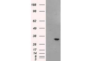 HEK293T cells were transfected with the pCMV6-ENTRY control (Left lane) or pCMV6-ENTRY BIRC7 (Right lane) cDNA for 48 hrs and lysed. (BIRC7 Antikörper)