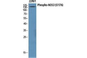 Western Blot (WB) analysis of specific cells using Phospho-NOS3 (S1177) Polyclonal Antibody. (ENOS Antikörper  (pSer1177))