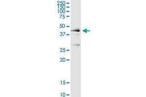 CTSD MaxPab rabbit polyclonal antibody. (Cathepsin D Antikörper  (AA 1-412))
