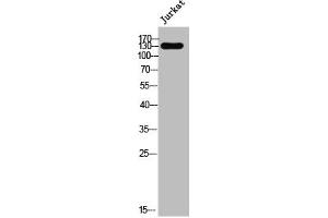 Nesprin3 Antikörper  (Internal Region)