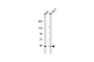 All lanes : Anti-MEFV Antibody (Center) at 1:1000 dilution Lane 1: A431 whole cell lysate Lane 2: ZR-75-1 whole cell lysate Lysates/proteins at 20 μg per lane. (MEFV Antikörper  (AA 418-445))
