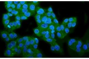 IF analysis of WFS1 using anti-WFS1 antibody (ABIN7602165). (WFS1 Antikörper  (AA 61-313))