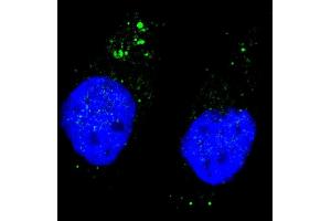 Fluorescent image of  cells stained with ULK1 (phospho ) antibody.