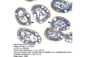 Immunohistochemistry (IHC) image for anti-Nudix (Nucleoside Diphosphate Linked Moiety X)-Type Motif 21 (NUDT21) (N-Term) antibody (ABIN2779017)