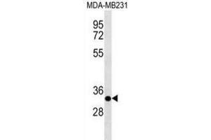 Western Blotting (WB) image for anti-Calpain, Small Subunit 2 (CAPNS2) antibody (ABIN3000891) (CAPNS2 Antikörper)