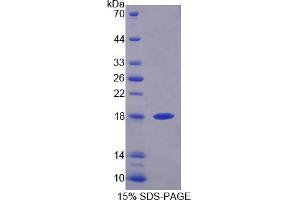 Image no. 1 for Dual Specificity Phosphatase 5 (DUSP5) (AA 1-135) protein (His tag) (ABIN6237142)