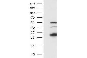 Image no. 8 for anti-Synovial Sarcoma, X Breakpoint 1 (SSX1) antibody (ABIN1501156)