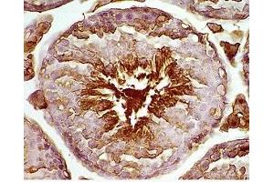 Mouse testis tissue was stained by rabbit Anti-Desnutrin (296-318) (Mouse) Serum (PNPLA2 Antikörper  (AA 296-318))