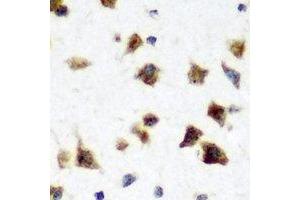 Immunohistochemical analysis of HuC staining in rat brain formalin fixed paraffin embedded tissue section. (HuC/ELAVL3 Antikörper)