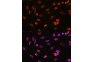 Immunofluorescence analysis of C6 cells using Histone H2AFV antibody (ABIN7267555) at dilution of 1:100. (H2AFV Antikörper  (AA 1-128))