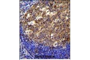 Immunohistochemistry (Paraffin-embedded Sections) (IHC (p)) image for anti-Twinfilin, Actin-Binding Protein, Homolog 2 (Drosophila) (TWF2) (AA 28-57), (N-Term) antibody (ABIN655611)