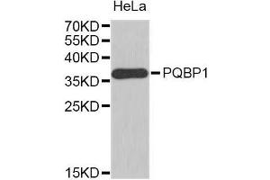 Western Blotting (WB) image for anti-Polyglutamine Binding Protein 1 (PQBP1) (AA 1-265) antibody (ABIN1682273) (PQBP1 Antikörper  (AA 1-265))