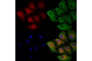 ABIN6263284 and ABIN6272925 staining Hela cells by IF/ICC. (MLYCD Antikörper  (Internal Region))