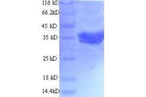 TLN2 Protein (AA 88-406) (His-SUMO Tag)