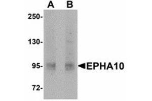 Image no. 1 for anti-EPH Receptor A10 (EPHA10) (N-Term) antibody (ABIN478123) (EPH Receptor A10 Antikörper  (N-Term))