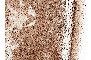 Immunohistochemistry analysis using Rabbit Anti-CCR2 Polyclonal Antibody (ABIN5066699). (CCR2 Antikörper  (Atto 594))