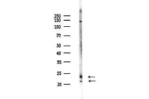 anti-Transmembrane 4 Superfamily Member 4 (TM4SF4) antibody