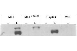 Image no. 1 for anti-SMAD, Mothers Against DPP Homolog 3 (SMAD3) (AA 417-425), (pSer423), (pSer425) antibody (ABIN401332) (SMAD3 Antikörper  (pSer423, pSer425))