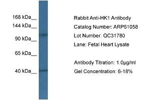Western Blotting (WB) image for anti-Hexokinase 1 (HK1) (Middle Region) antibody (ABIN2788662) (Hexokinase 1 Antikörper  (Middle Region))