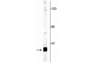 Western blot of rat cortical lysate showing specific labeling of the ~25 kDa SNAP25 protein. (SNAP25 Antikörper  (C-Term))