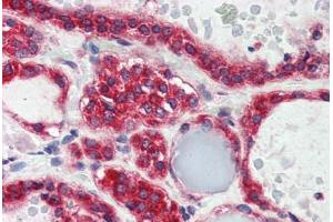 Human Thyroid (formalin-fixed, paraffin-embedded) stained with LPIN3 antibody ABIN337225 at 2. (LPIN3 Antikörper  (AA 149-160))