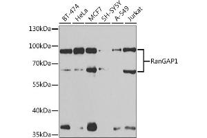 Western blot analysis of extracts of various cell lines, using RanG antibody (ABIN6128613, ABIN6146681, ABIN6146683 and ABIN6217306) at 1:1000 dilution. (RANGAP1 Antikörper  (AA 398-587))