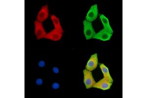 ABIN7095851 and ABIN7099913 staining Hela cells by IF/ICC. (SSX6 Antikörper)