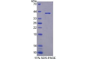 Image no. 1 for S100 Calcium Binding Protein A10 (S100A10) (AA 2-97) protein (His tag,GST tag) (ABIN6237762)